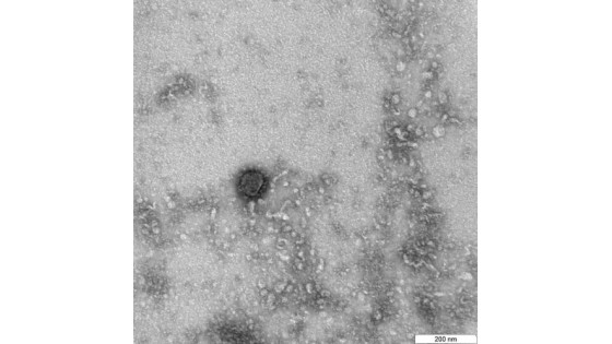 Российские ученые секвенировали полный геном SARS-CoV-2
